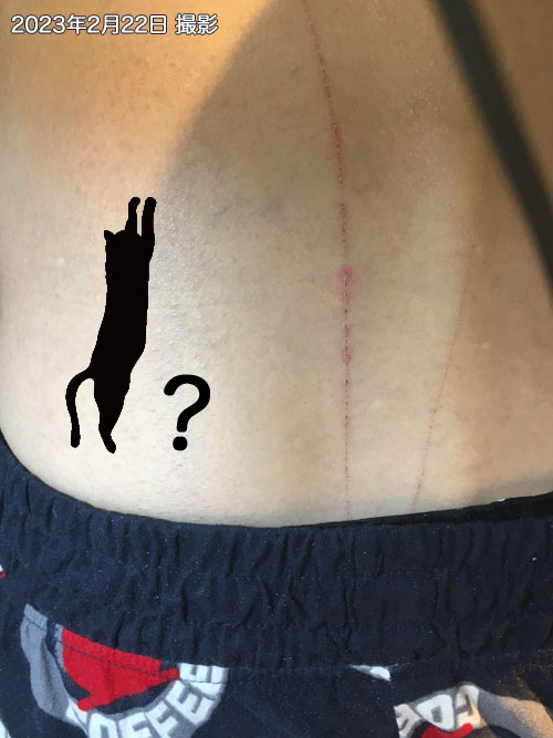 猫のひっかき傷